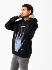 ACUPUNCTURE - Felpa hoodie Not Judgmental black